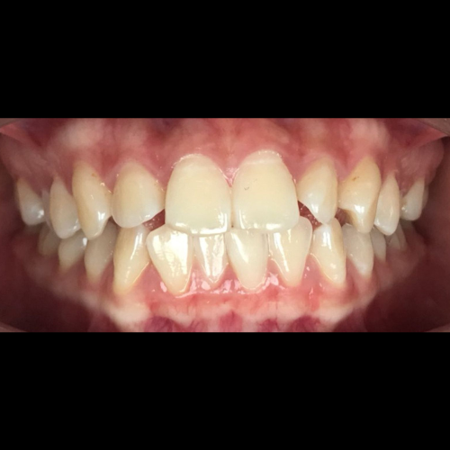 Before treatment