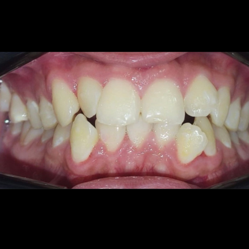 Before treatment