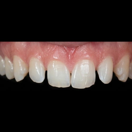 Before treatment